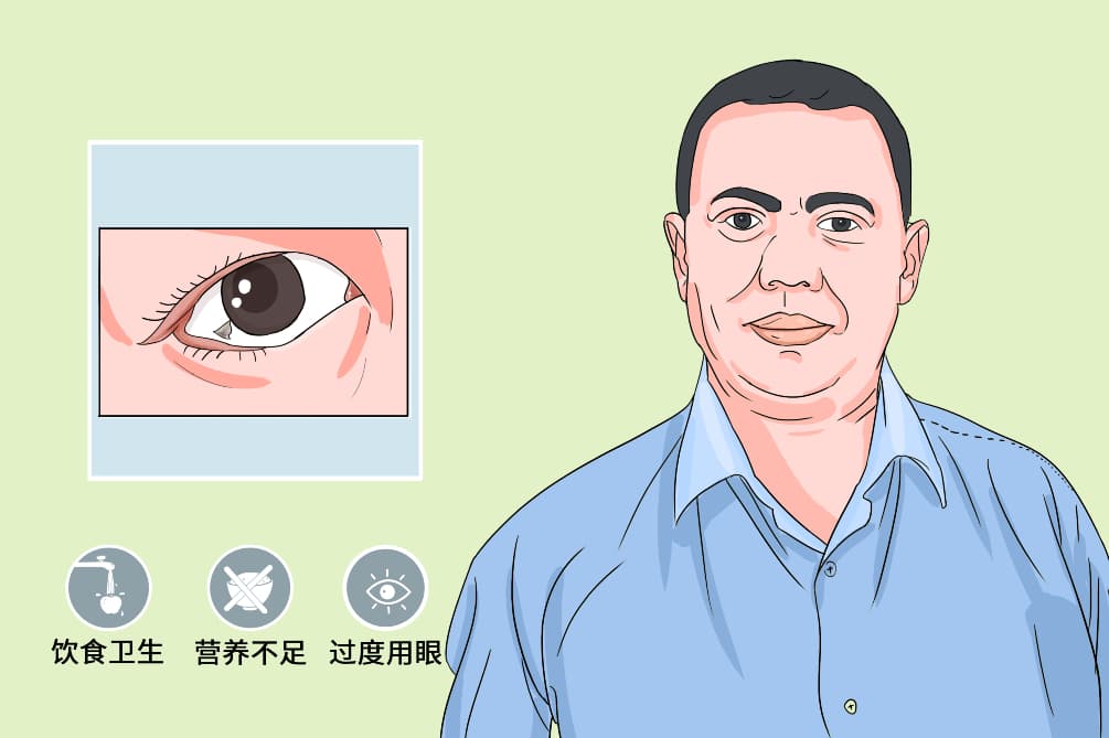 眼球上有白色膜状物怎么办