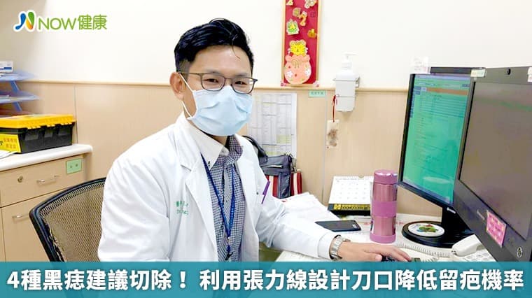 4种黑痣建议切除！ 利用张力线设计刀口降低留疤机率