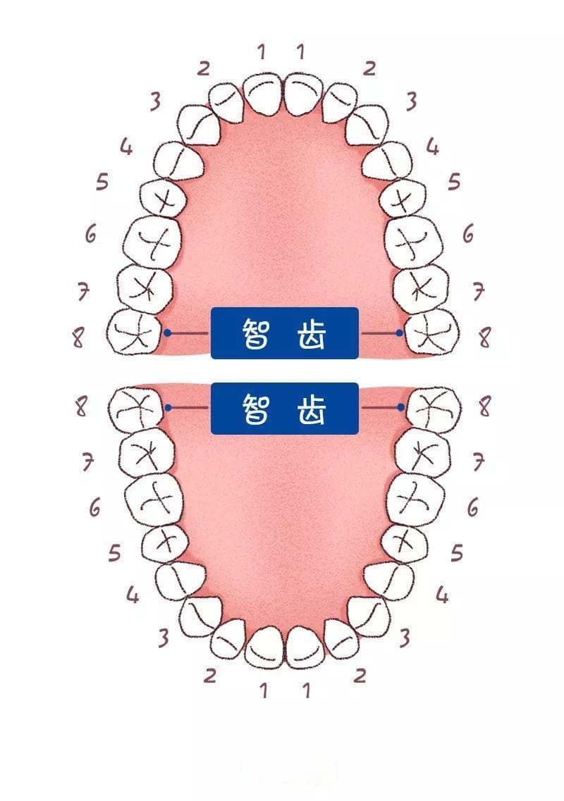 智齿那些事儿：生长、困扰及解决办法