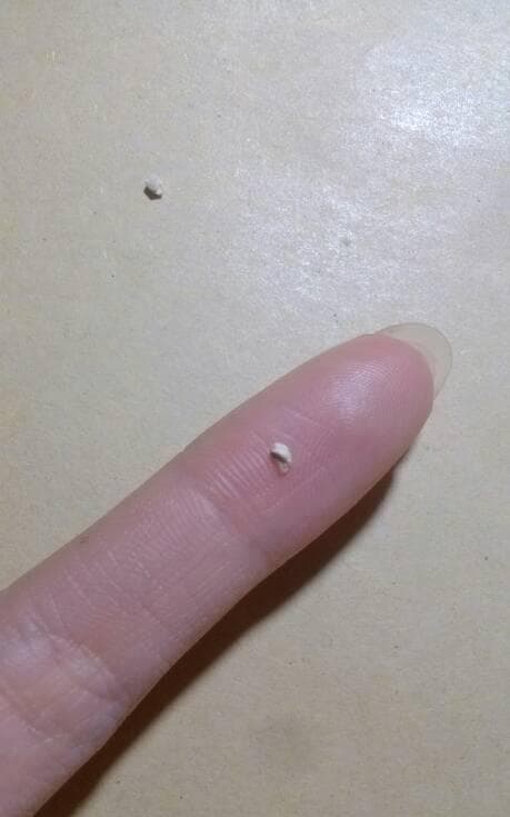 梦见牙掉了一块：多重解读与深层含义