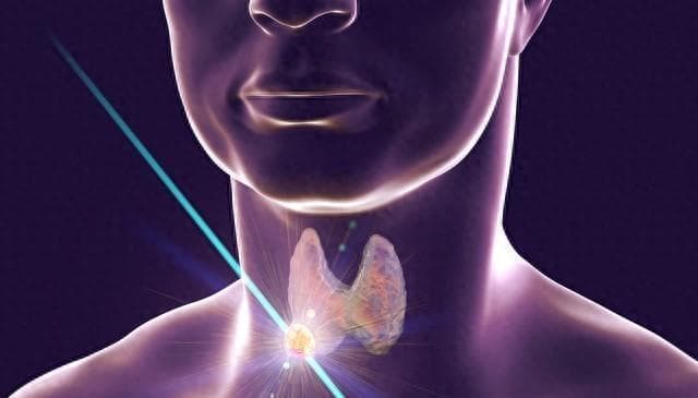 “甲状腺结节”离“癌”有多远？甲状腺结节的超声检查报告怎么看