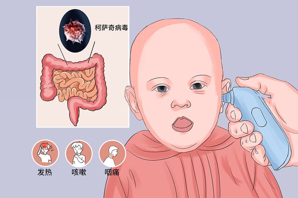 柯萨奇病毒感染