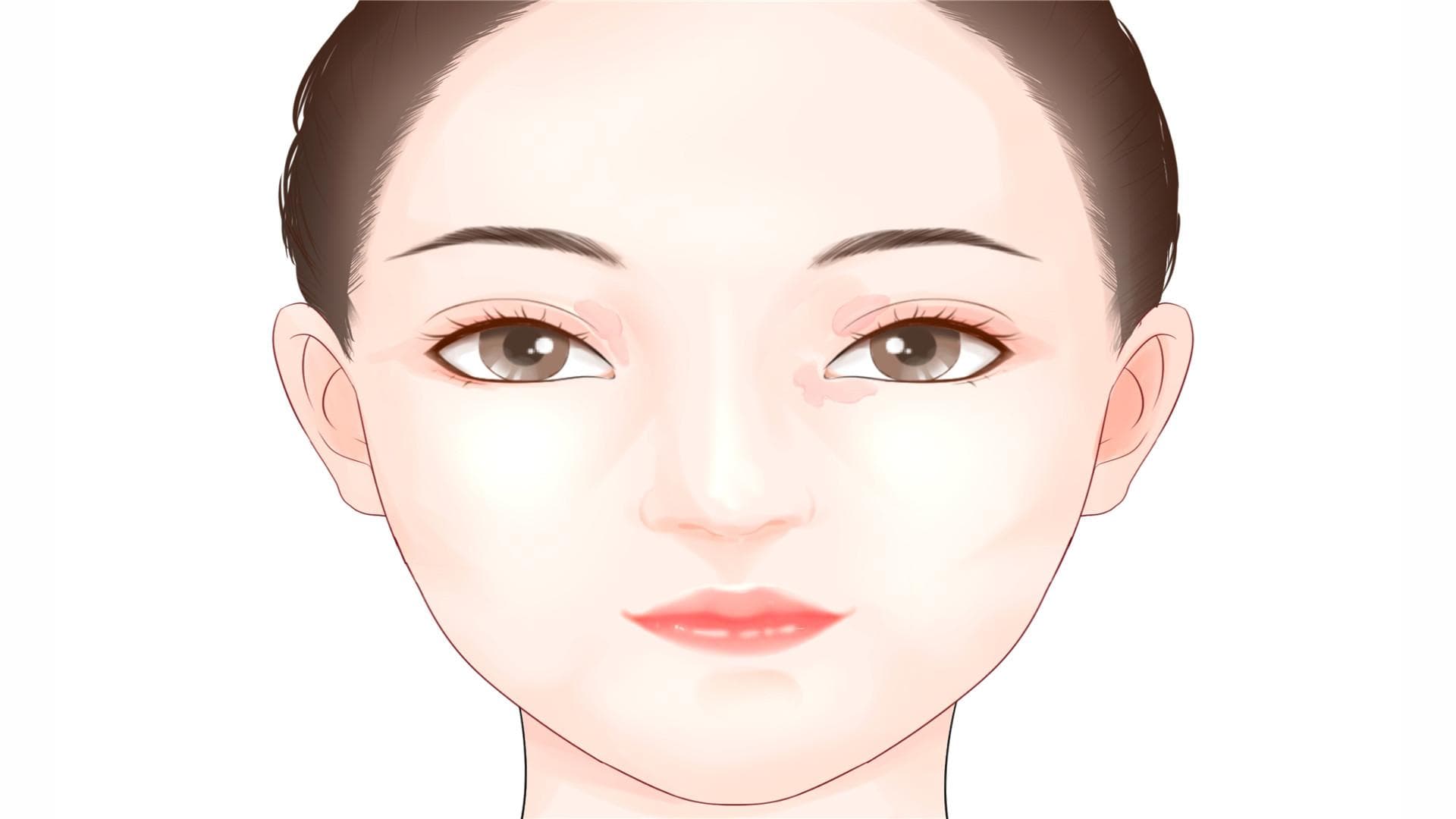 激光美白有副作用吗 如何应对激光美白带来的副作用