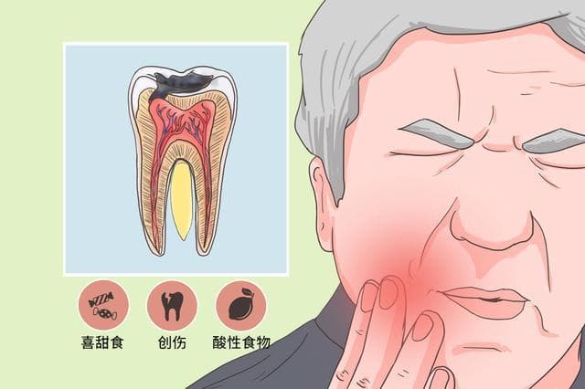 “晚上牙疼得要命！”关于急性牙髓炎，听听专家怎么说