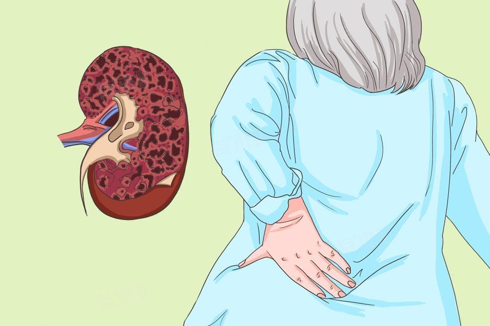 尿毒症透析：血液透析与腹膜透析的原理、过程及注意事项