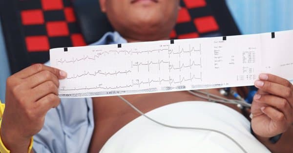 脉搏低是什么原因引起的