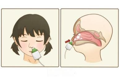宝宝鼻炎了？鼻腔冲洗有讲究