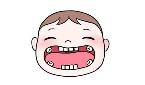 儿童早期矫治的常见问题 看完这篇不纠结