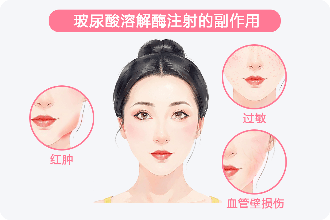 玻尿酸溶解酶的副作用及使用注意事项