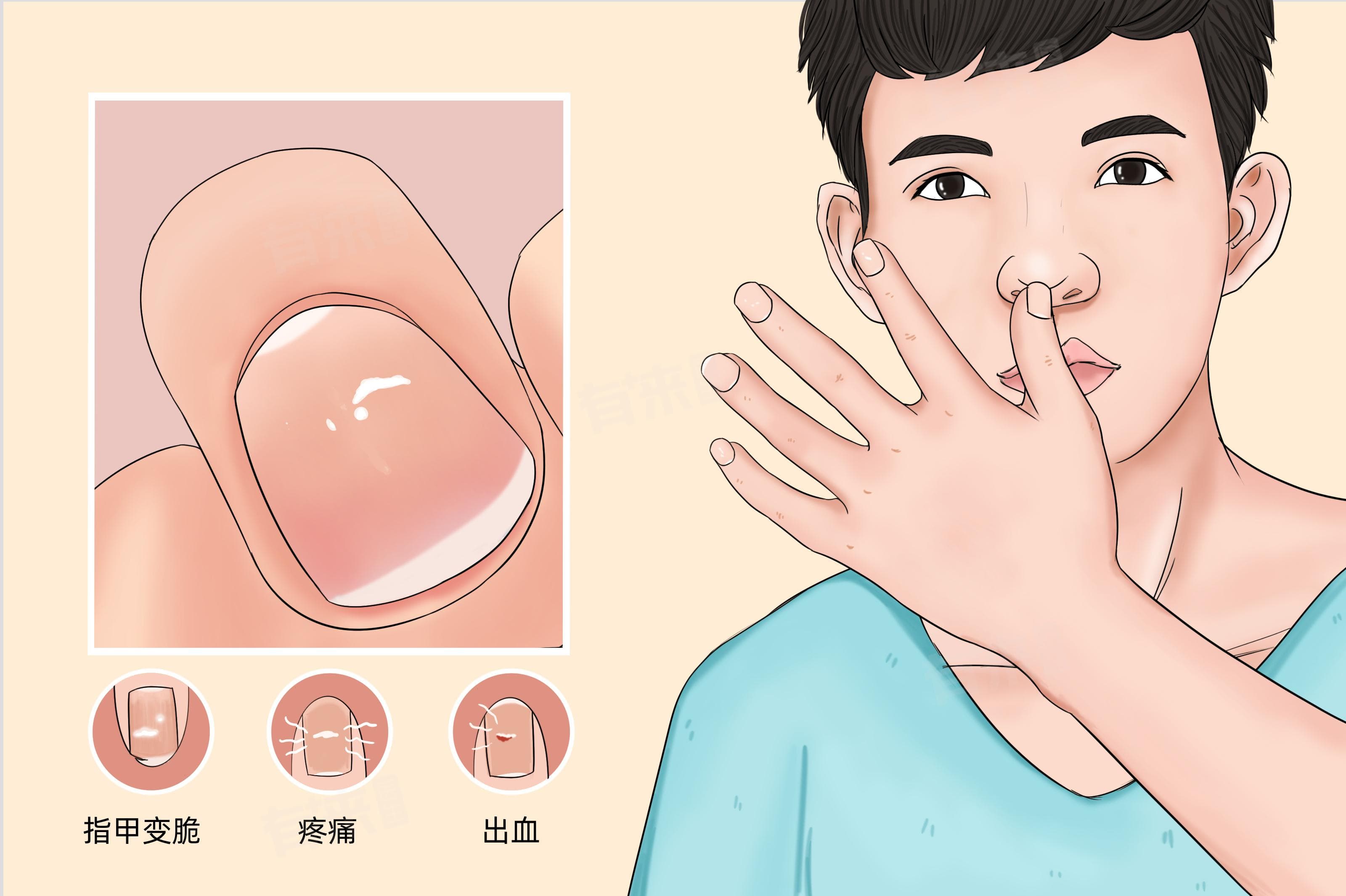 小孩子指甲上有白点是怎么回事