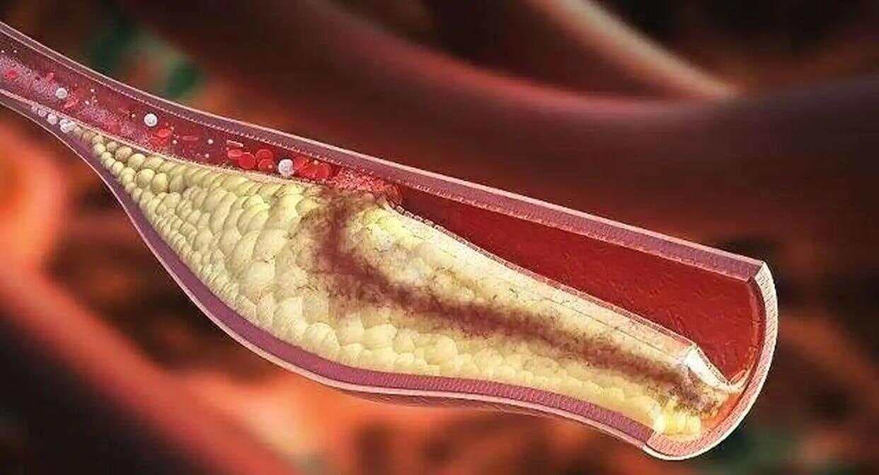 不想血脂失控，多吃这些食物