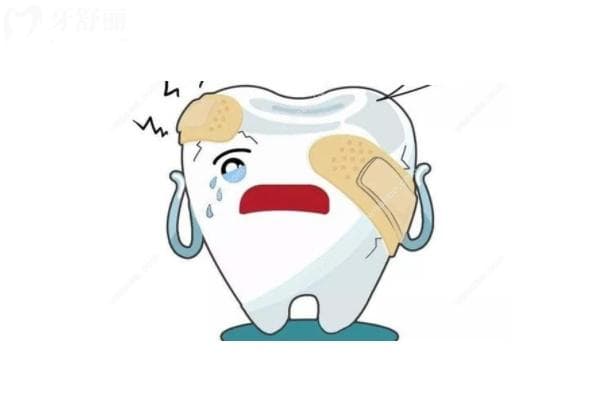 根管治疗后牙裂了怎么办？牙裂的原因以及解决方法请收好