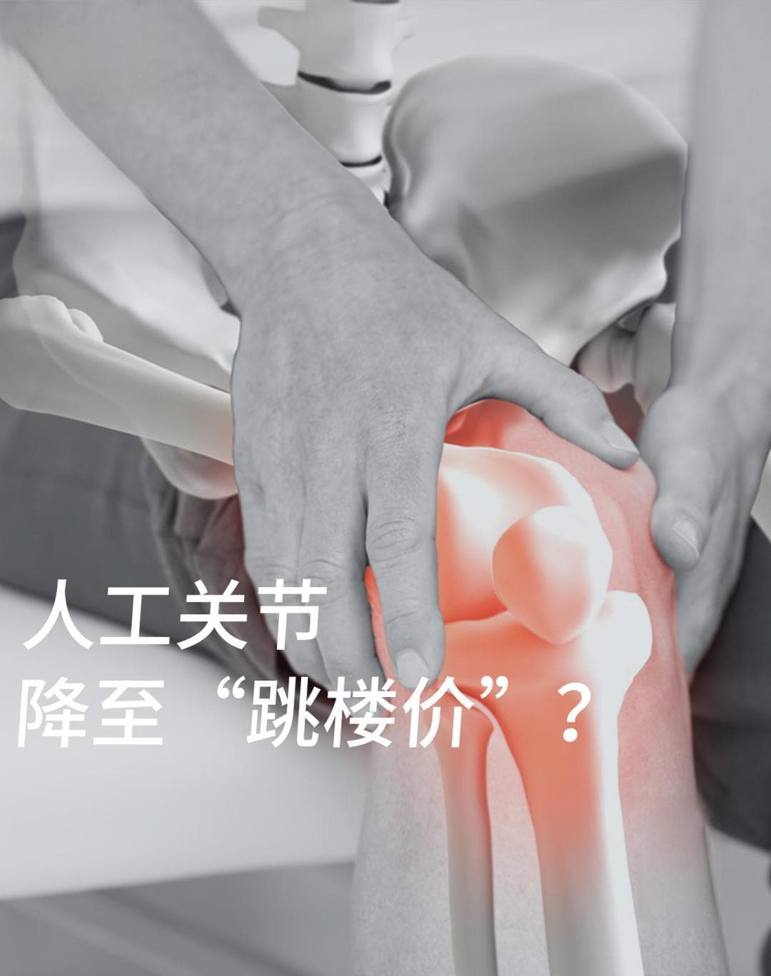人工关节费用降到千元后，为何患者更担忧了？