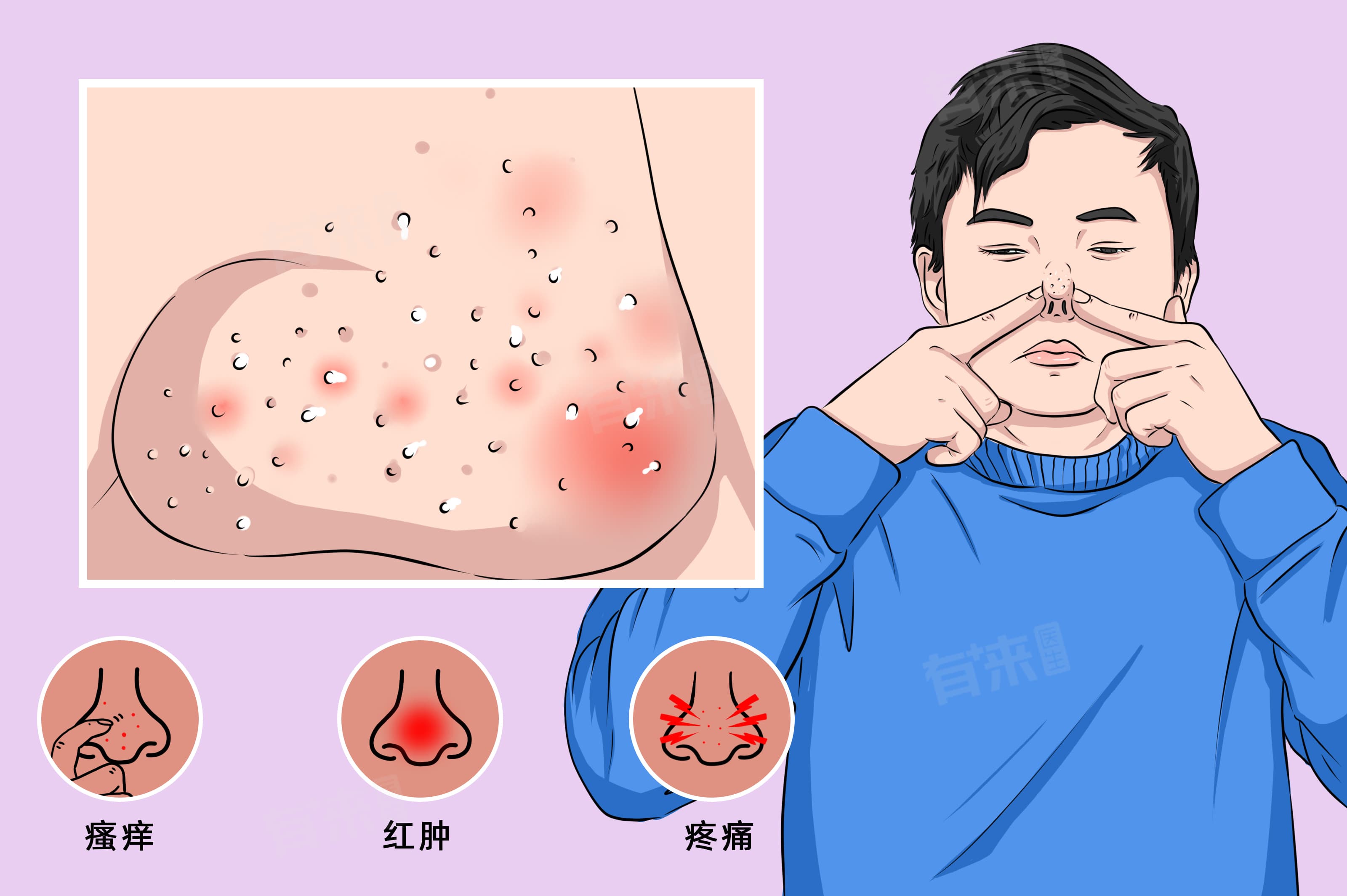 脸上毛孔粗大怎么改善