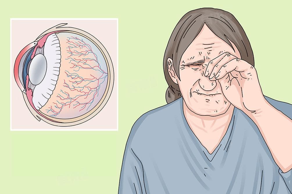 老人眼睛老是流眼泪是怎么回事