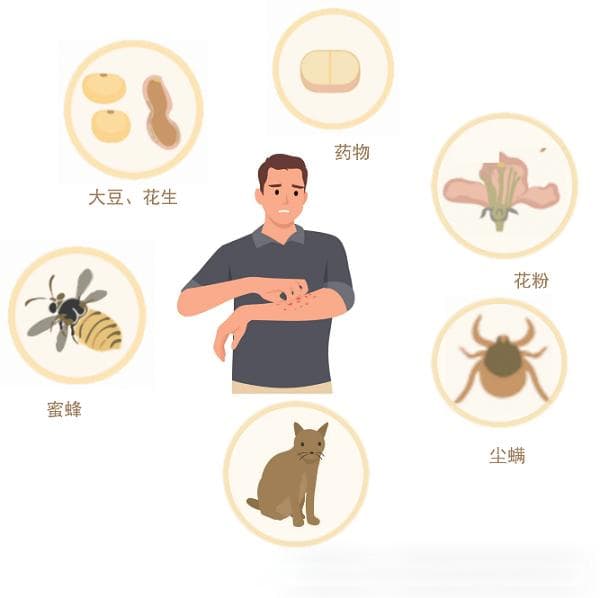 食物过敏中的那些糖蛋白