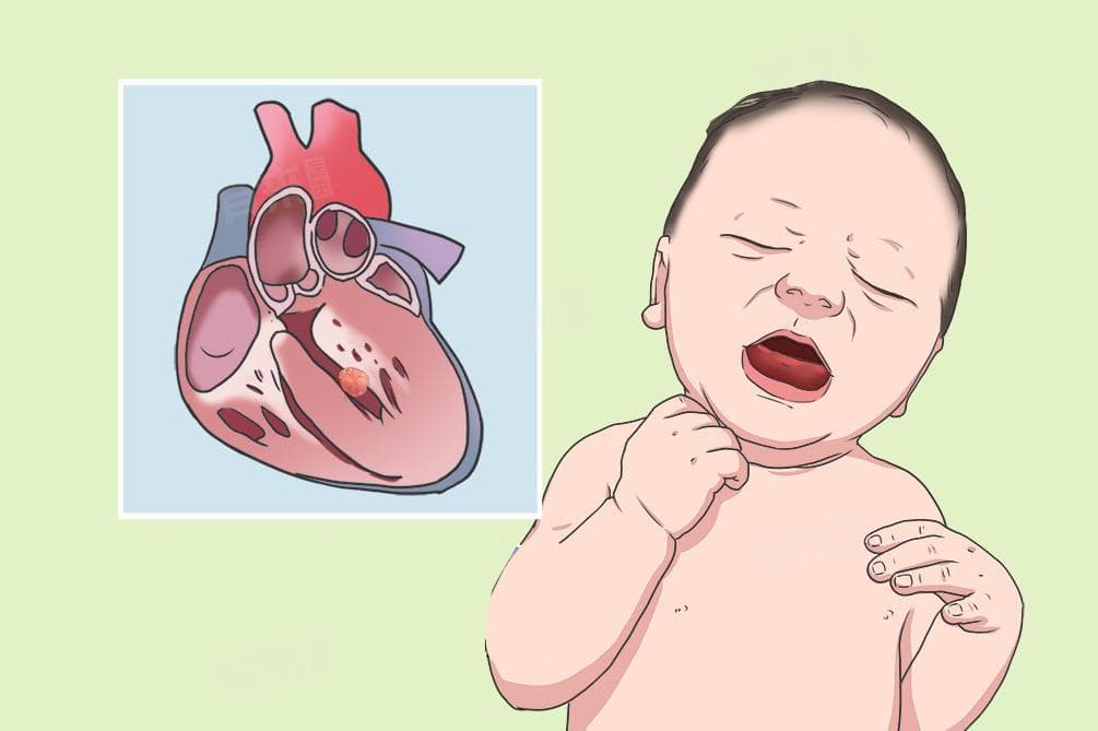 小孩心脏疼是什么原因