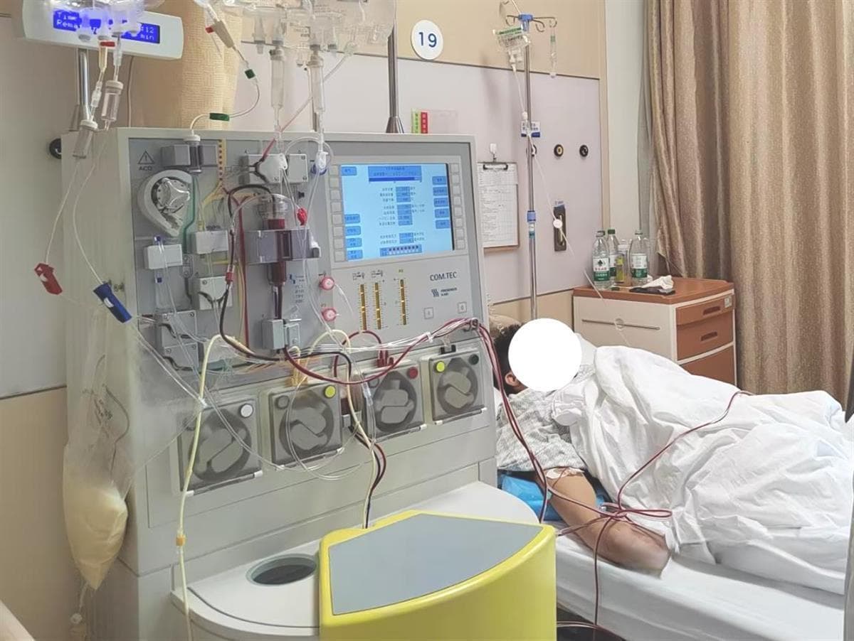 五旬男子甘油三酯高出正常值10倍　“血脂净化”置换出600毫升“油浆”