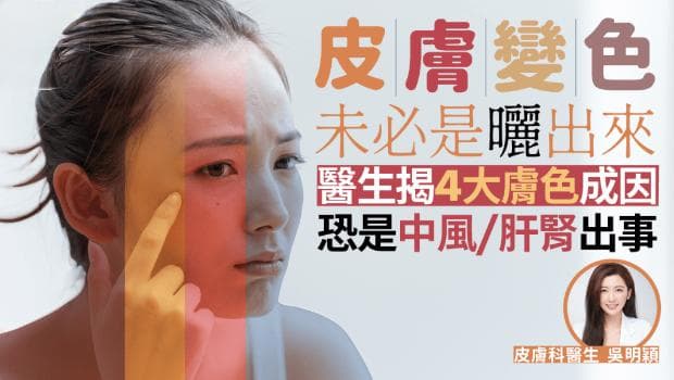 皮肤变色未必是晒出来！医生揭4大肤色成因，恐是中风/肝肾出事