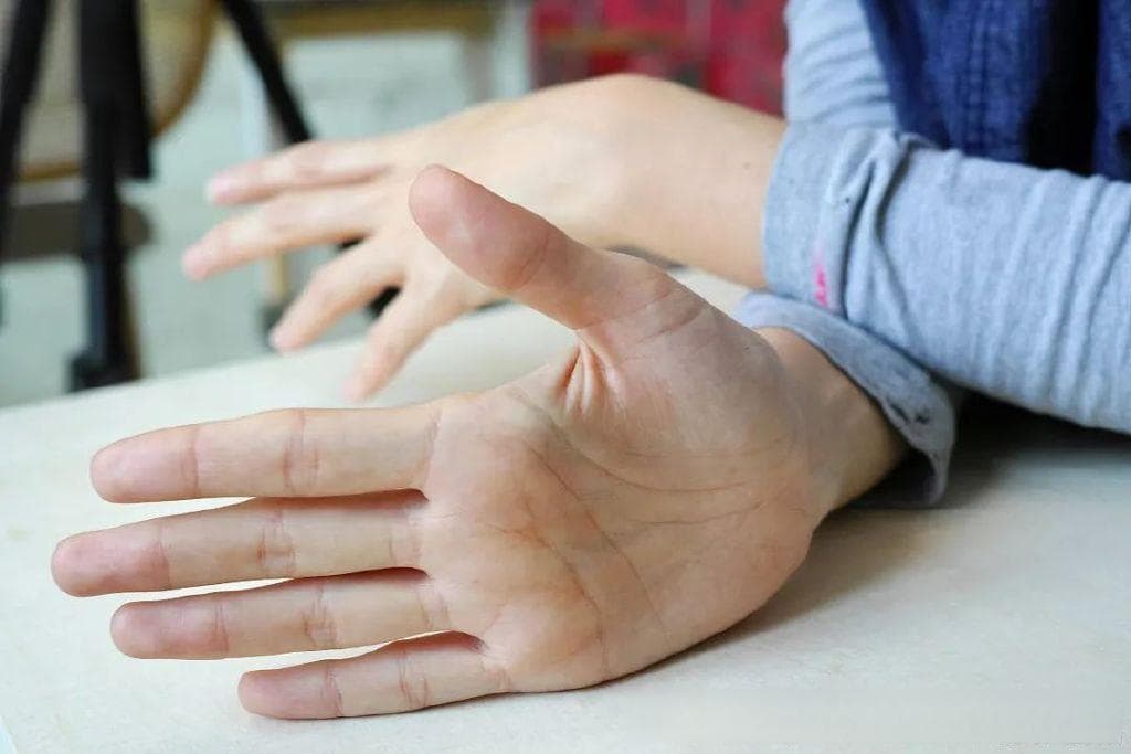 特发性震颤：如何应对那些“不自主”的手抖瞬间？