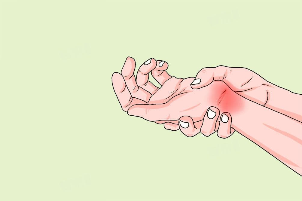 怎样判断得腕管综合症