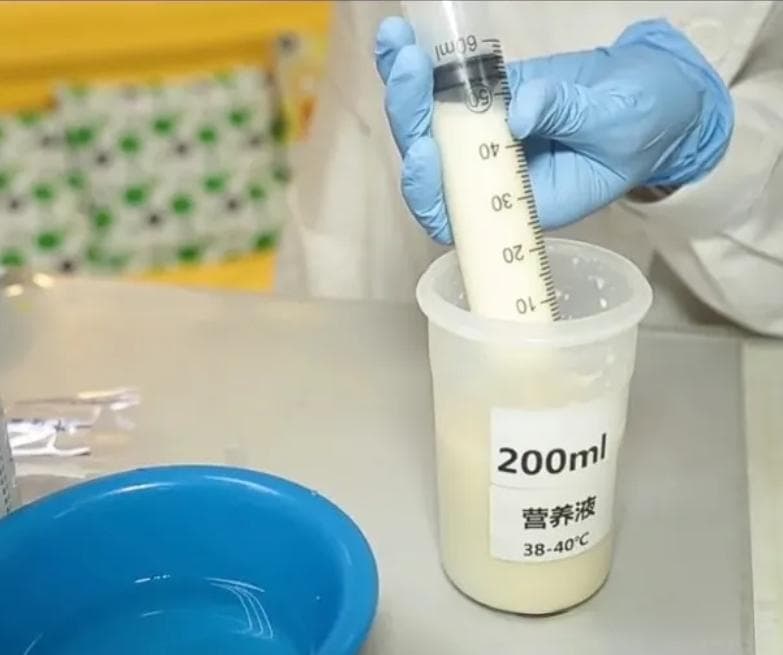 经皮内镜下胃造瘘（PEG）术后护理全攻略