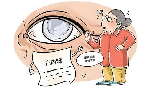 新上市的散光矫正型三焦点人工晶状体临床应用效果显著