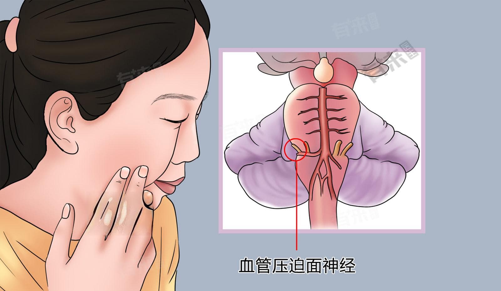 检查大脑神经做什么检查