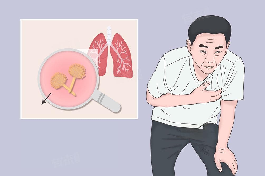 ABPA是什么意思