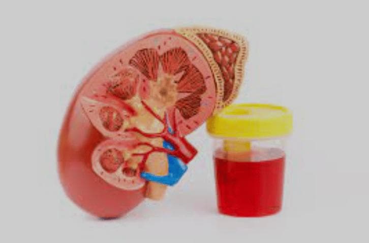 生化诊断的尿液四项检测：窥探健康的简单窗口