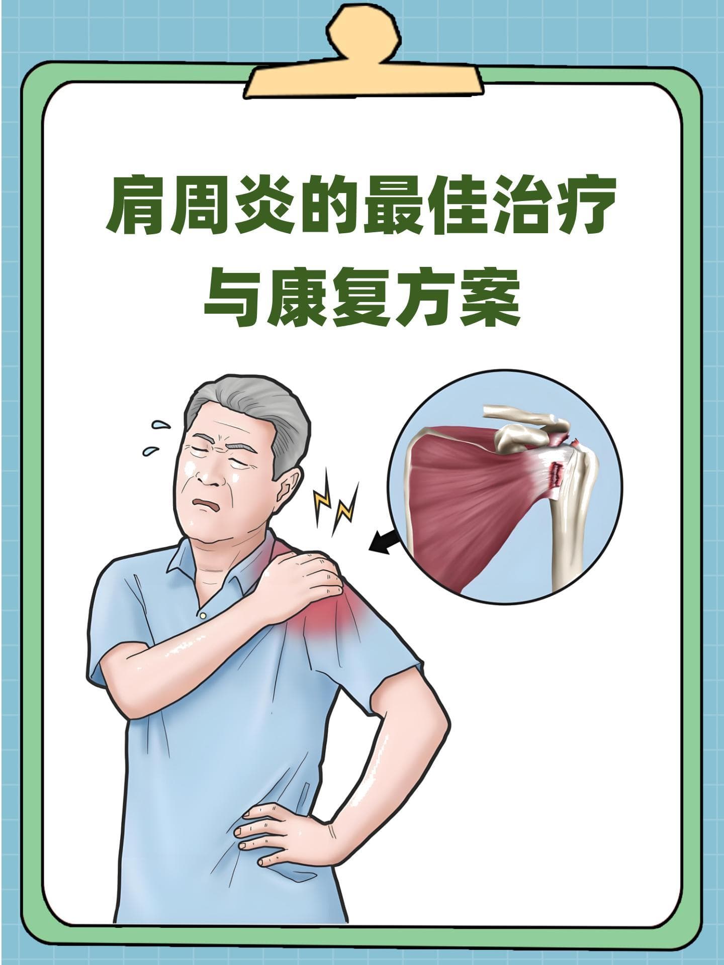 肩周炎的最佳治疗与康复方案