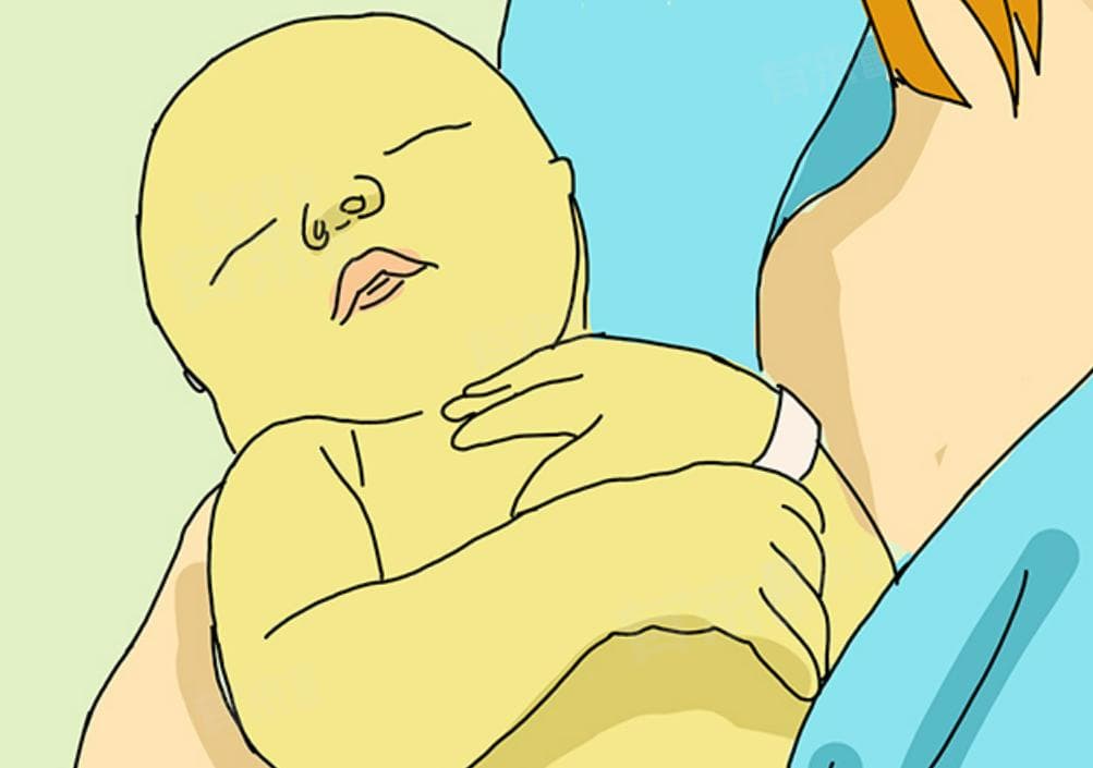 造成母乳性黄疸的原因有哪些