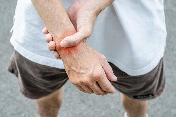 手腕滑膜炎是什么？症状、诊断与治疗方法全解析