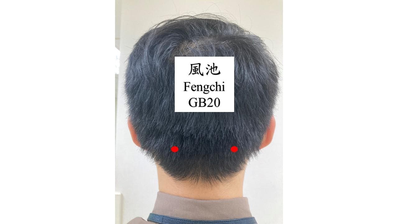偏头痛的预防与保健