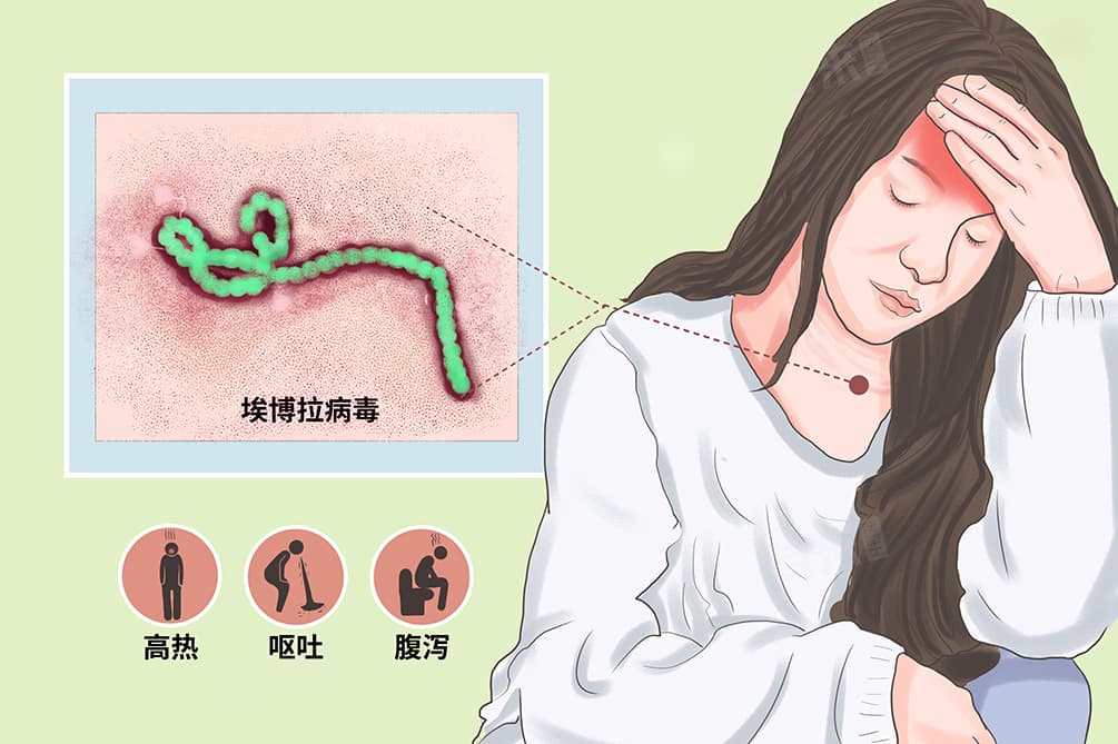 埃博拉病毒病：特性、传播途径与预防措施全解析