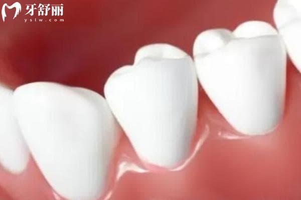 如何预防牙龈萎缩？整理常见牙龈萎缩成因以及解决措施