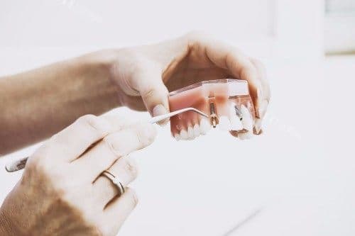 孩子门牙磕断了还能接回去吗？能！文内教您正确的处理方法
