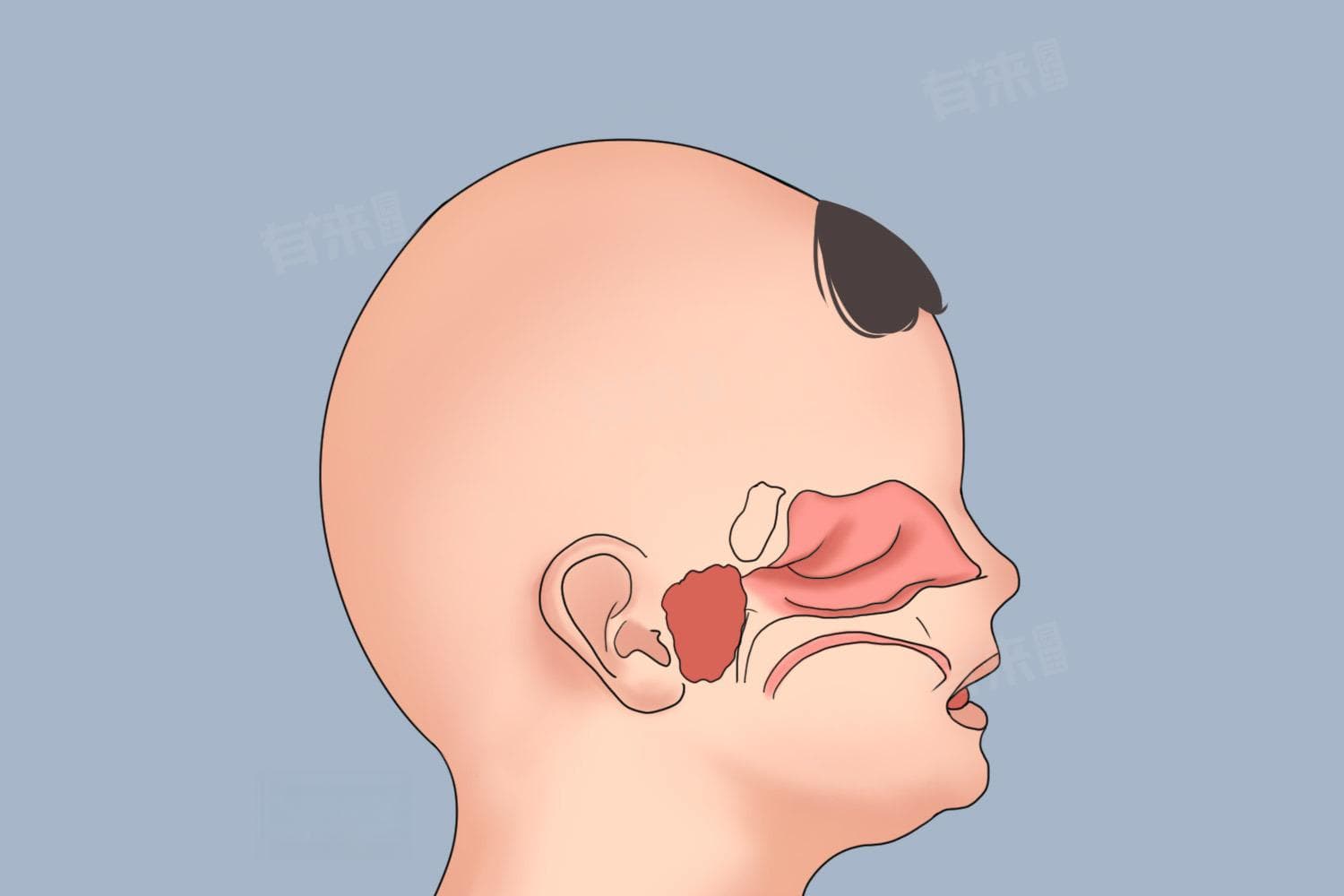 儿童腺样体肥大怎么治疗最好