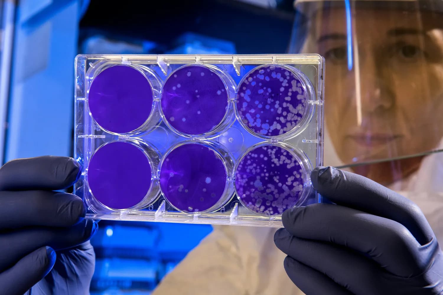 纽约大学新研究：肾脏细胞也有记忆？