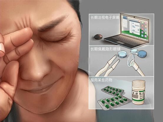 健康科普 | “你的眼睛也需要运动！六步给眼睛‘敷’上泪膜，告别干眼症！”