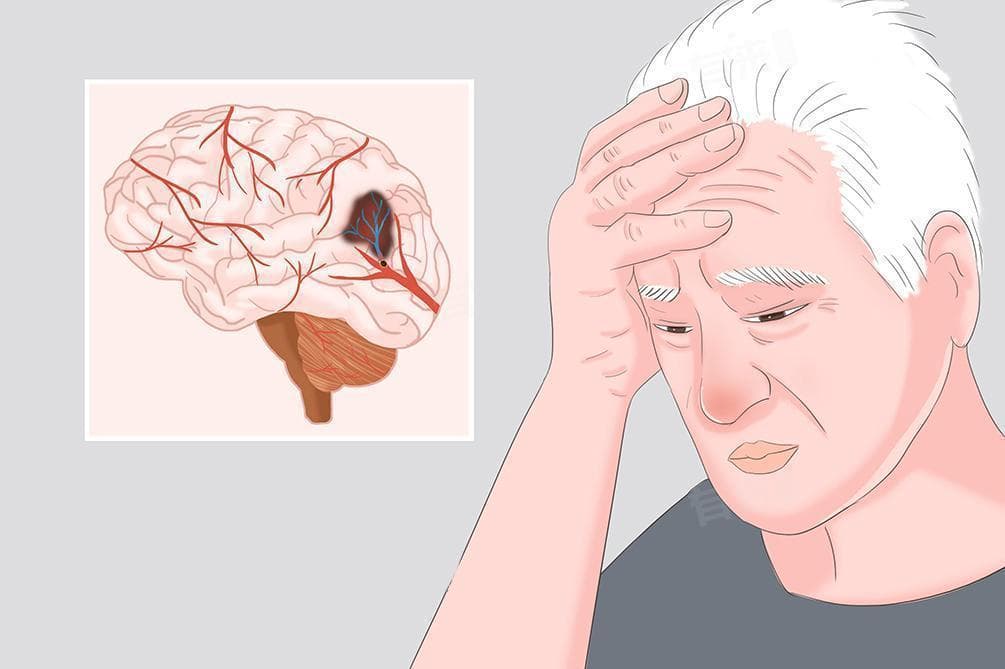 双侧基底节区腔隙性脑梗塞严重吗