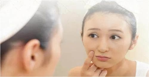 黄褐斑的成因、诊断与防治全攻略