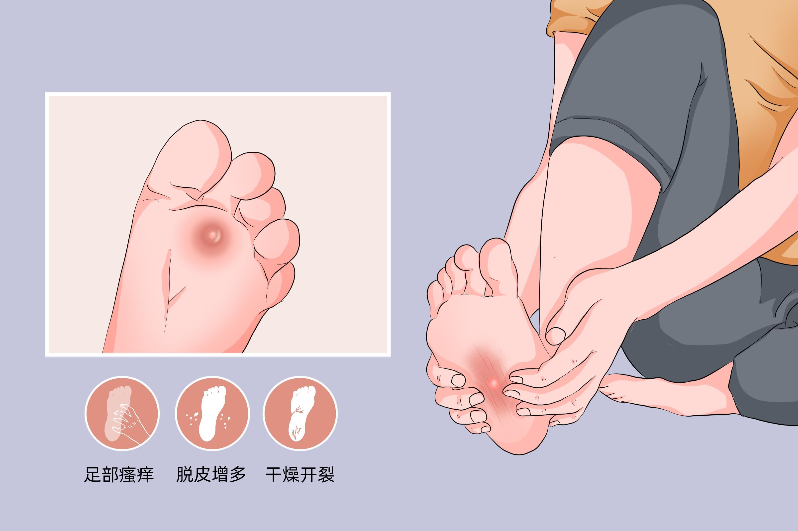 水泡自然吸收好还是挑破？一文详解处理方法