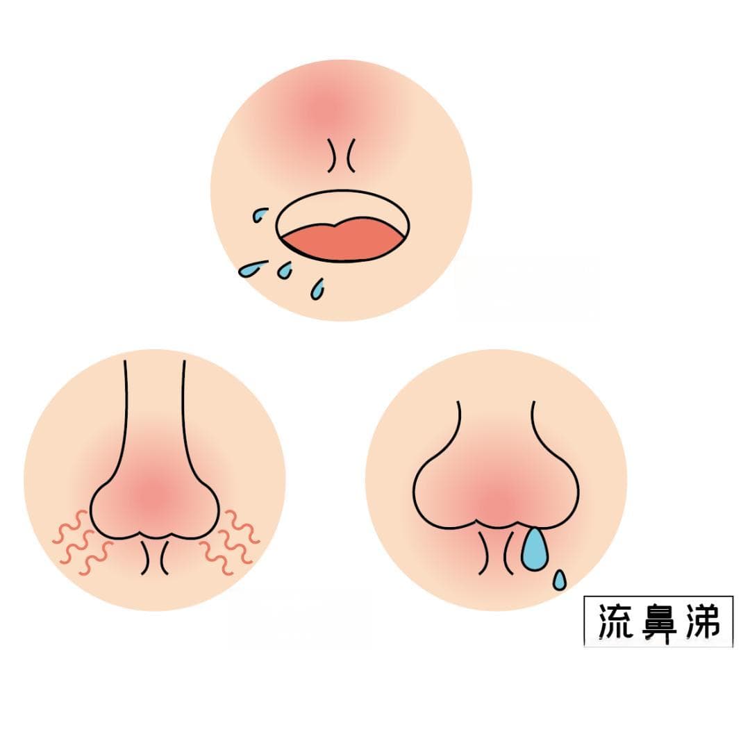 经常鼻塞？原因和对策要知道→
