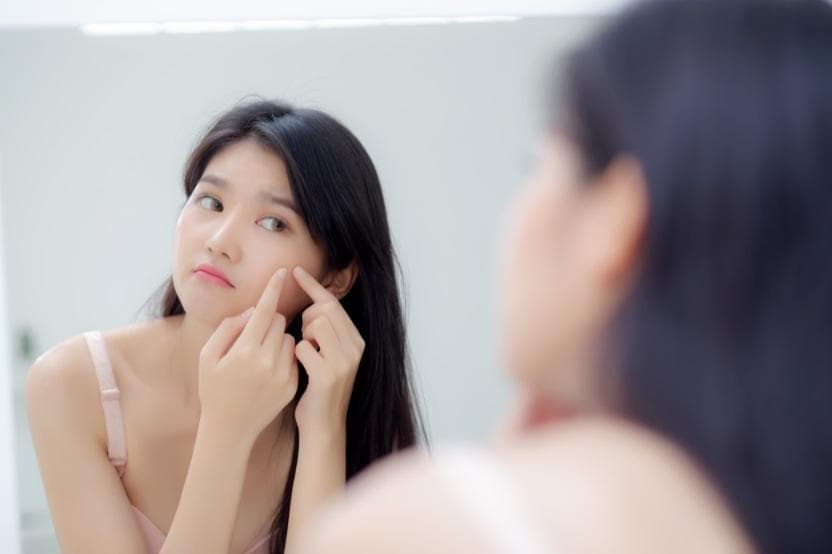 服用异维A酸软胶囊治疗痤疮安全吗？要注意什么？