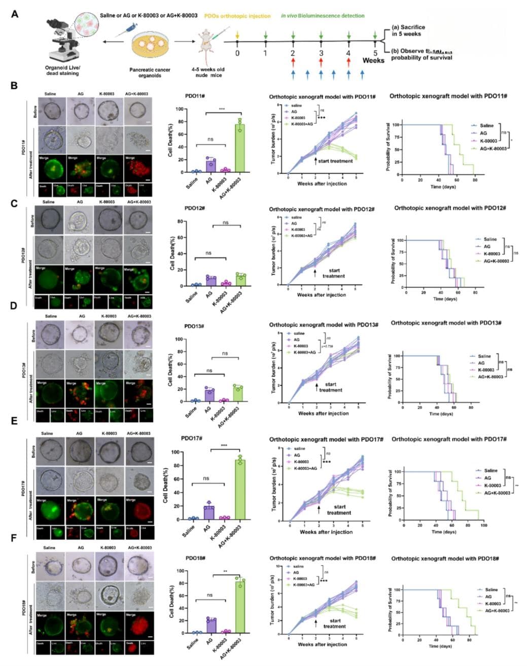 Molecular Cancer丨克服胰腺导管腺癌化疗耐药性