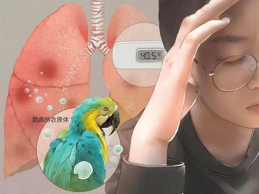 “鹦鹉热衣原体肺炎”知多少