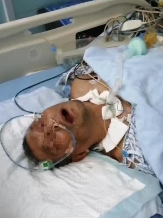 没打破伤风差点送命！医生提醒：接触土壤、铁锈的伤口要注意