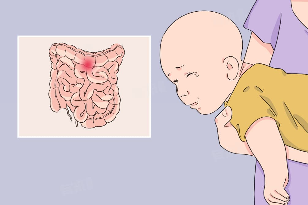 肠痉挛怎么缓解最快