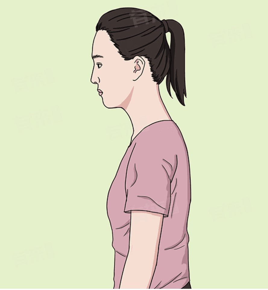 马凡综合征：一种遗传性结缔组织疾病